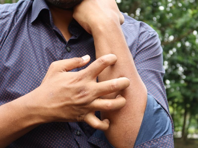 mevsimsel-alerjide-bagisiklik-sistemi-nasil-tepki-verir